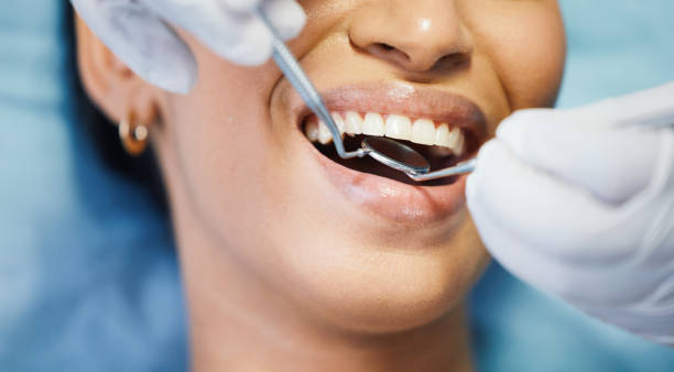 Best Broken or Chipped Tooth Repair in Orangeburg, NY
