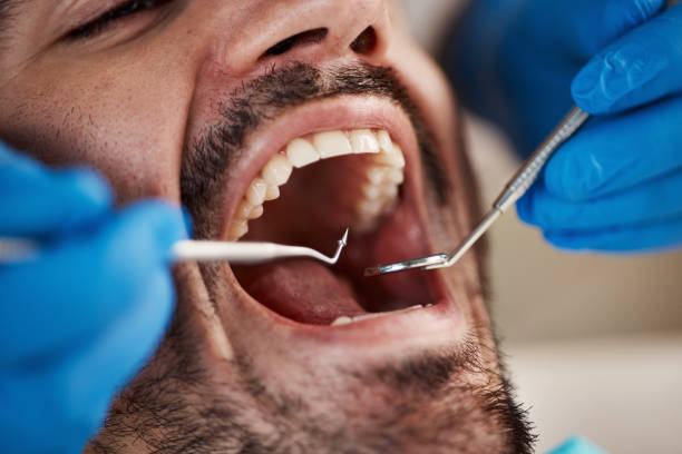 Professional Emergency Dental Service in NY