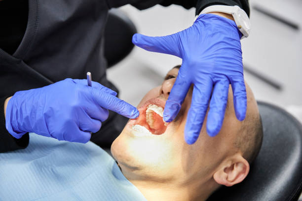 Best Dental Abscess Treatment in Orangeburg, NY