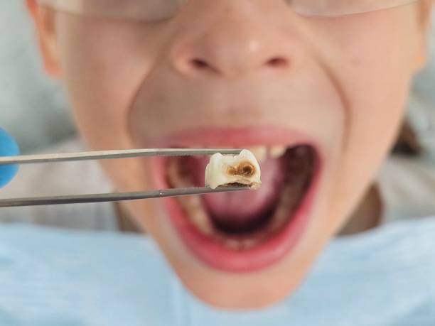 Best Emergency Treatment for Jaw Pain or Injury in Orangeburg, NY